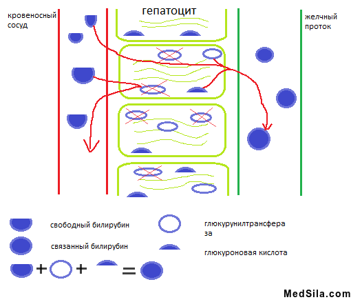 Схема развития билирубинемии при болезни Жильбера.